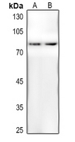 WB - Anti-AKT (pT450) Antibody AP60532